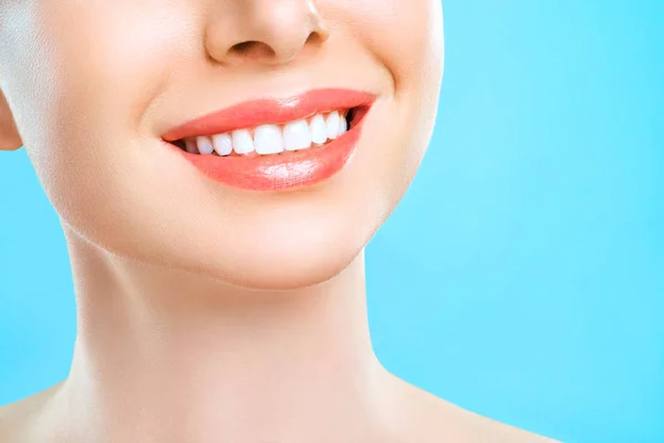 Sonrisa de dientes sanos perfectos de una mujer joven. Blanqueamiento dental. Paciente de la clínica dental. Estomatología, concepto odontológico . — Foto de Stock