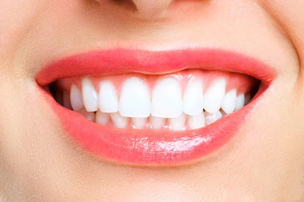 Sonrisa de dientes sanos perfectos de una mujer joven. Blanqueamiento dental. Paciente de la clínica dental. Concepto de estomatología. — Foto de Stock