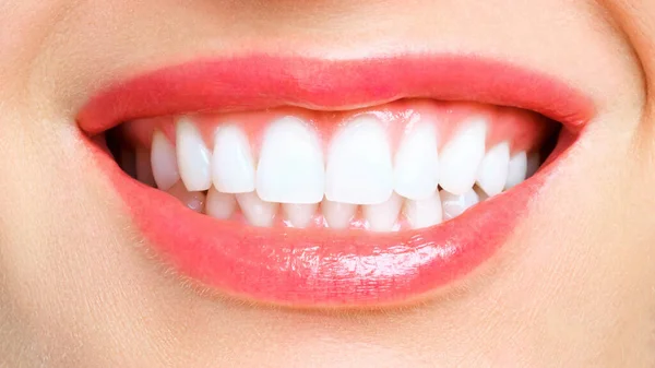 Genç bir kadının mükemmel sağlıklı dişli gülümsemesi. Diş beyazlatma. Diş sağlığı kliniği hastası. Resim, oral bakım dişçiliği ve stomatolojiyi sembolize eder — Stok fotoğraf