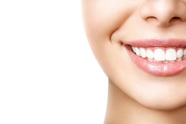 Mooie vrouwelijke glimlach na het bleken van tanden procedure. Tandheelkundige zorg. Tandheelkundig concept — Stockfoto
