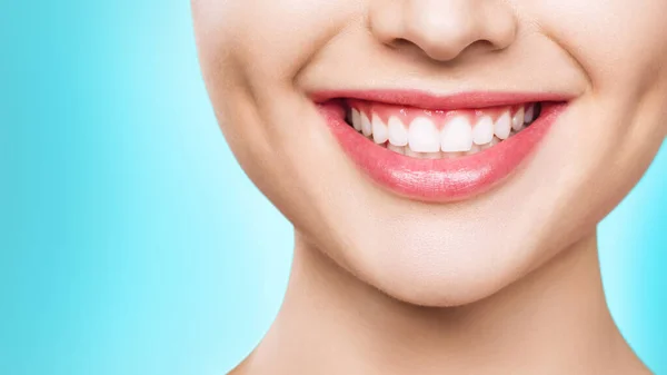 Closeup του χαμόγελου με λευκά υγιή δόντια. — Φωτογραφία Αρχείου