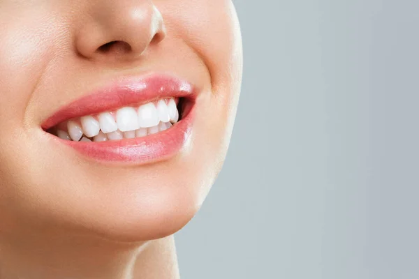 Sonrisa de dientes sanos perfectos de una mujer joven. Blanqueamiento dental. Paciente de la clínica dental. Concepto de estomatología. — Foto de Stock