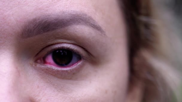 Jovem mulher olha para a câmera enquanto pupila dos olhos muda de cor — Vídeo de Stock