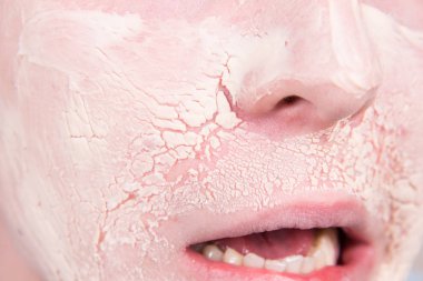 Erkek güzeli. Sivilce. Cilt sorunları.