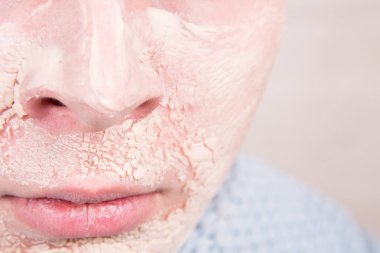 Erkek güzeli. Sivilce. Cilt sorunları.