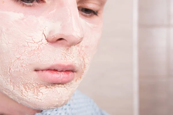 Male Beauty Acne Skin Problems — Stock Photo, Image