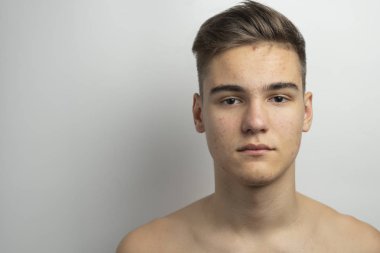 Teen sivilce ve akne yüz ile