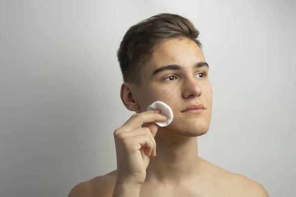 a young boy with pimples and acne on a face