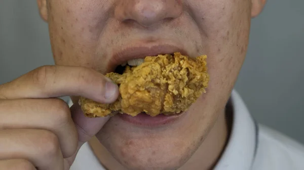 Chico con granos y acné en la cara está comiendo comida rápida, de cerca — Foto de Stock