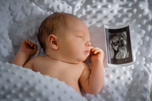 毛布の上で新生児を眠る超音波撮影 — ストック写真