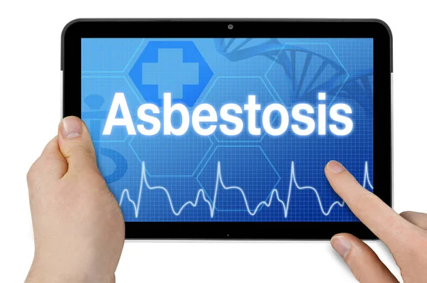 Tablett Med Medicinsk Bakgrund Och Diagnostisk Asbestos — Stockfoto