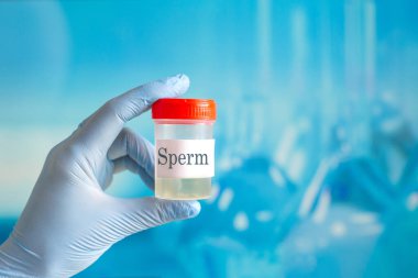 Sağlık. Sperm analizi. Banka Sperm kavramı. Kısırlık. İçin kapsayıcı tutan doktor el analiz eder