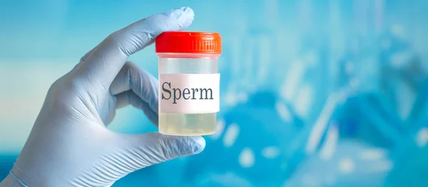 Sağlık. Sperm analizi. Banka Sperm kavramı. Kısırlık. İçin kapsayıcı tutan doktor el analiz eder