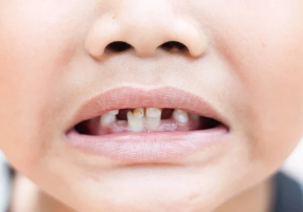 Medicina Dentária Cuidados Saúde — Fotografia de Stock