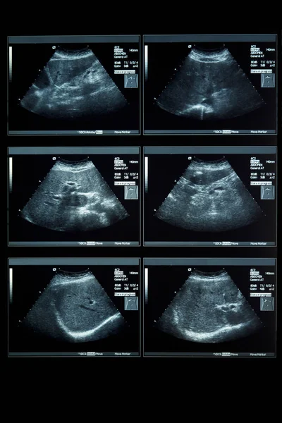 Ultrasonografia Analisi Della Femmina — Foto Stock