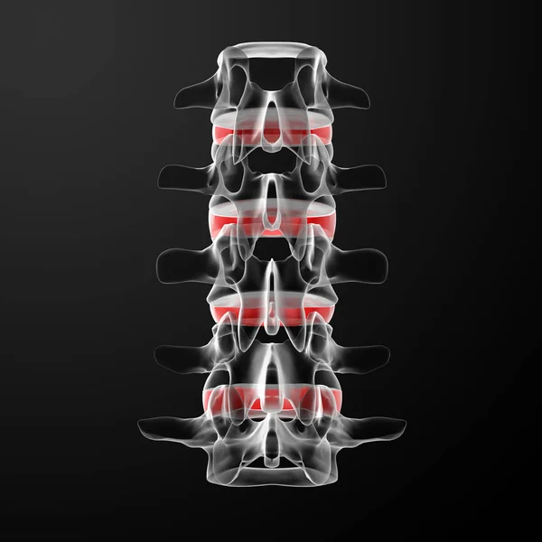 レンダリング ヒト椎間板 背面図 — ストック写真