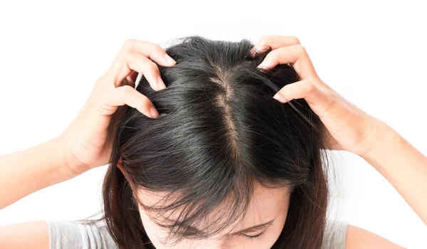 Wanita Closeup Tangan Gatal Kulit Kepala Konsep Perawatan Rambut — Stok Foto