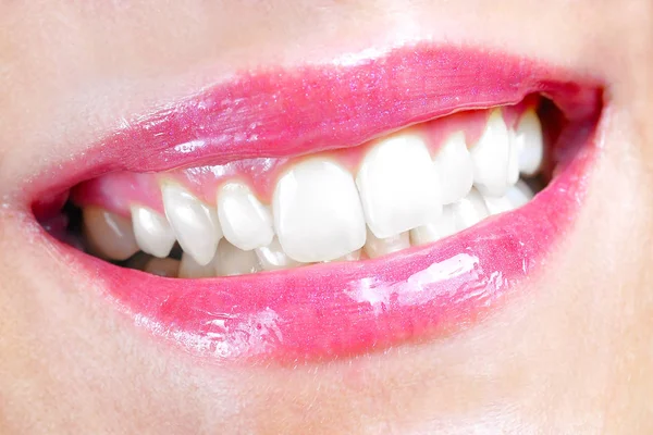 Uśmiechnięte Usta Kobiety Wielkie Zęby — Zdjęcie stockowe