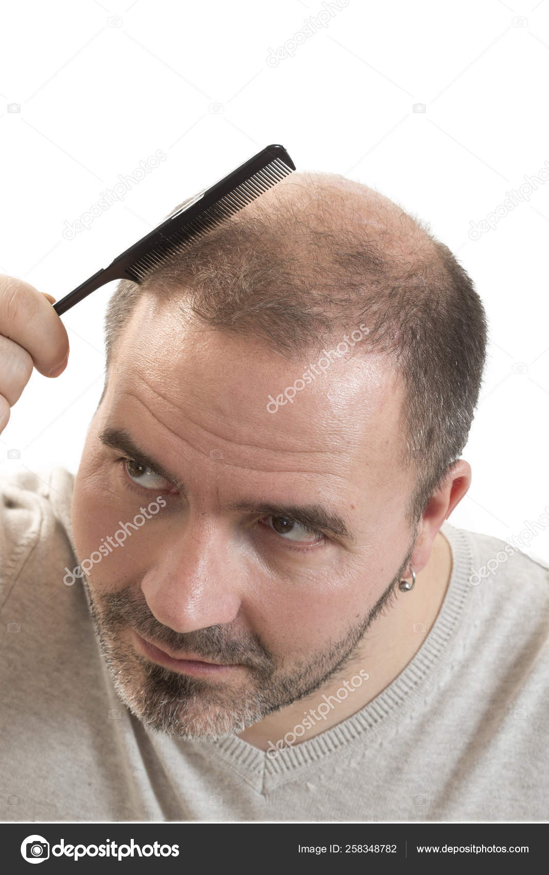 Baldness Alopecia Man Hair Loss Haircare Medicine Bald Treatment