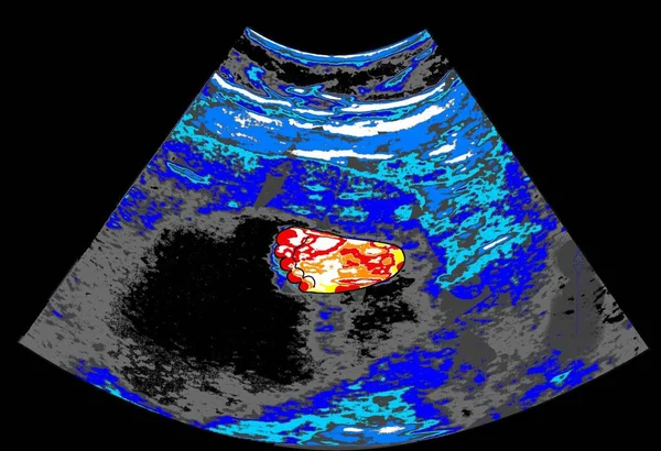 Gemalter Ultraschall Mit Dem Fuß Eines Babys Eine Raster Illustration — Stockfoto