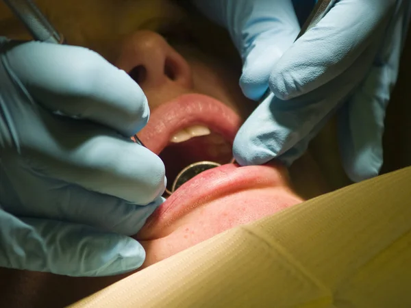 Tandläkare Händer Hållande Verktyg Och Inspektera Kvinnas Leende För Håligheter — Stockfoto