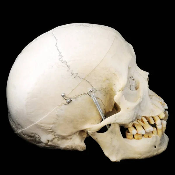 Cráneo Humano Real Con Mandíbula Abisagrada Cabeza Extraíble Vista Lateral — Foto de Stock