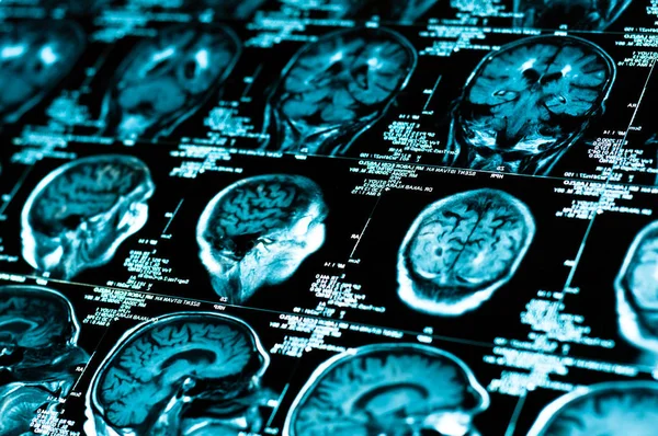 Sharp Scan Image Human Brain — Stock Photo, Image