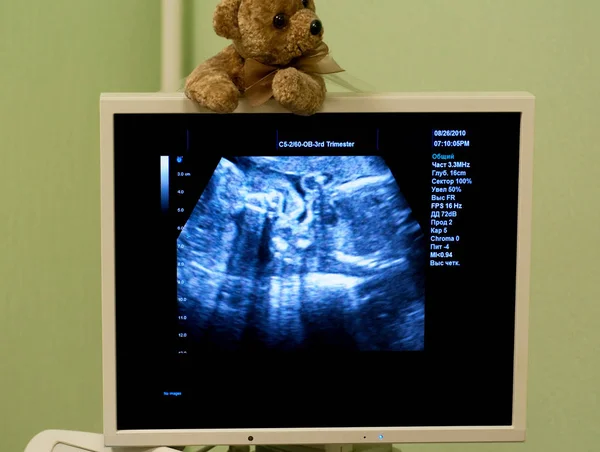 Położnik Badania Ciąży Brzuch Przez Ultradźwiękowy Skanowania — Zdjęcie stockowe