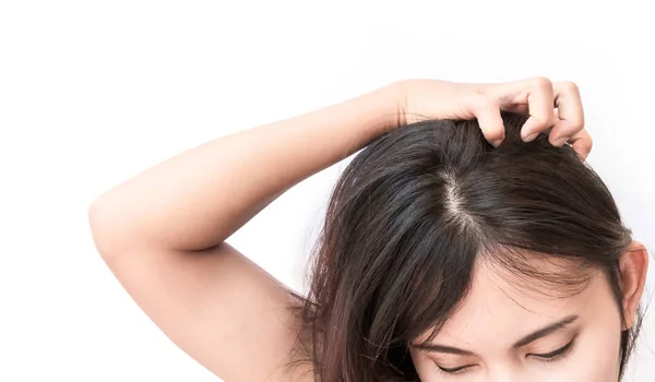 Closeup Woman Hand Itchy Scalp Hair Care Concept — Stock Photo, Image