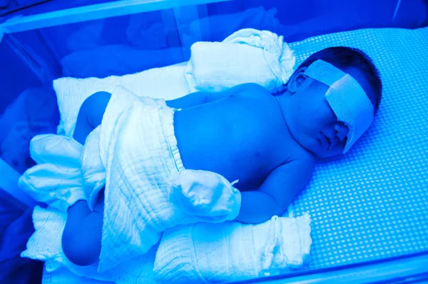 Νεογέννητο Μωρό Ίκτερο Υπό Υπεριώδη Λυχνία Στο Εκκολαπτήριο — Φωτογραφία Αρχείου
