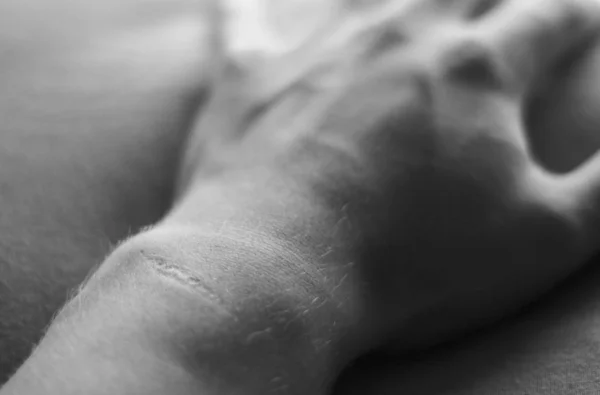 Uma Imagem Preto Branco Granulado Pulso Com Cicatrizes — Fotografia de Stock