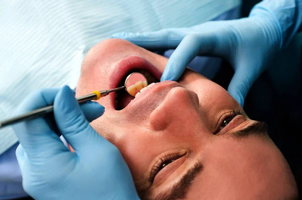 Manlig Patient Dental Checkup — Stockfoto