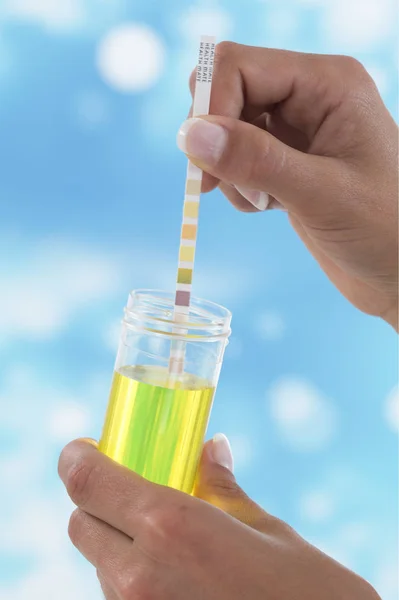 Teste Selft Com Tira Teste Urina — Fotografia de Stock