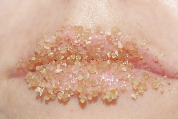 Widok Makro Kobiety Usta Pokryte Żółtym Cukrem — Zdjęcie stockowe