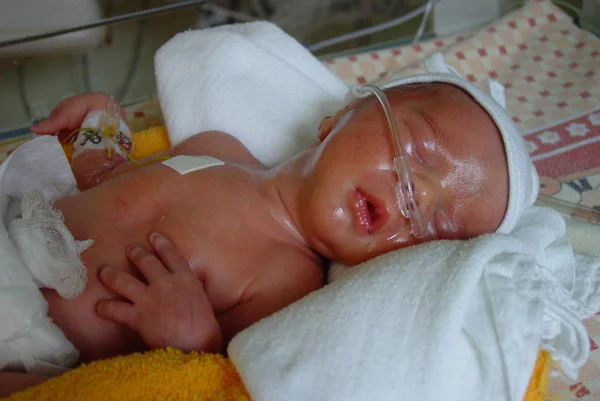 Premature Baby Met Zuurstoftherapie — Stockfoto