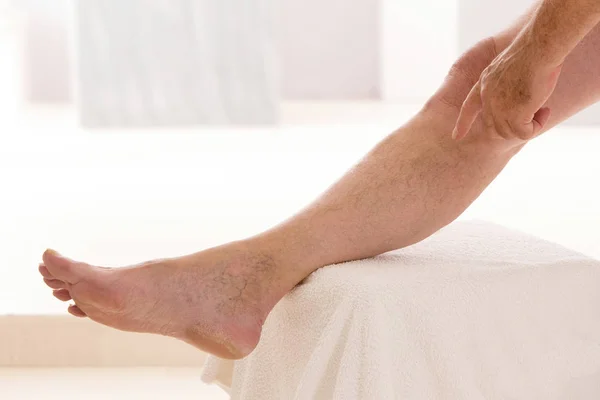 Varicose Veins Closeup Foot Modular Bath Step — Stock Photo, Image