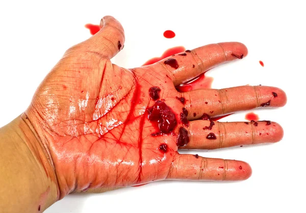 Krwawa Ręka Białym Tle — Zdjęcie stockowe