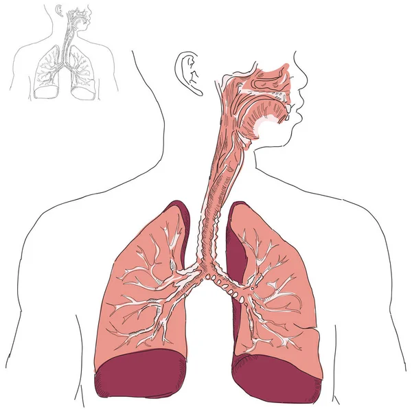 ヒトの呼吸器系とアクチノミコシス ベクターイラスト — ストック写真