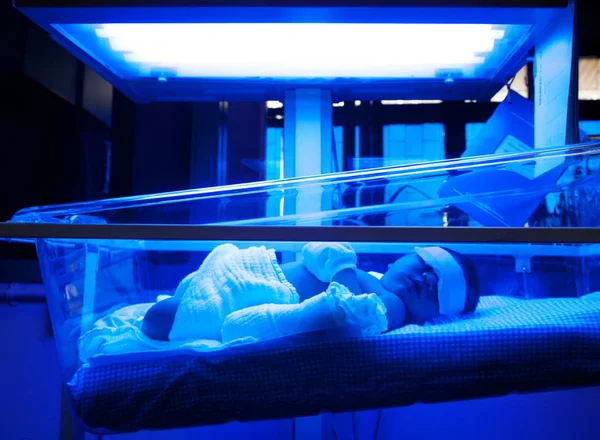 Neonato Con Ittero Sotto Luce Ultravioletta Nell Incubatrice — Foto Stock