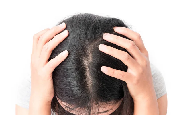 Closeup Mulher Mão Coceira Couro Cabeludo Conceito Cuidados Com Cabelo — Fotografia de Stock