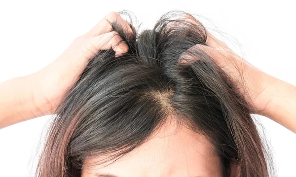 Closeup Žena Ruku Svědění Vlasové Pokožky Koncept Péče Vlasy — Stock fotografie