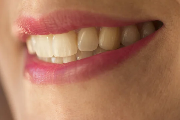 Makro Zbliżenie Usta Kobiety Wieku Pokazano Prostymi Zębami Różowa Szminka — Zdjęcie stockowe