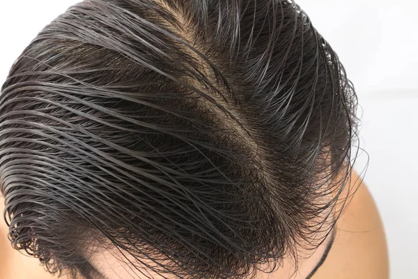 Joven Hombre Serio Problema Pérdida Cabello Para Cuidado Salud Champú — Foto de Stock