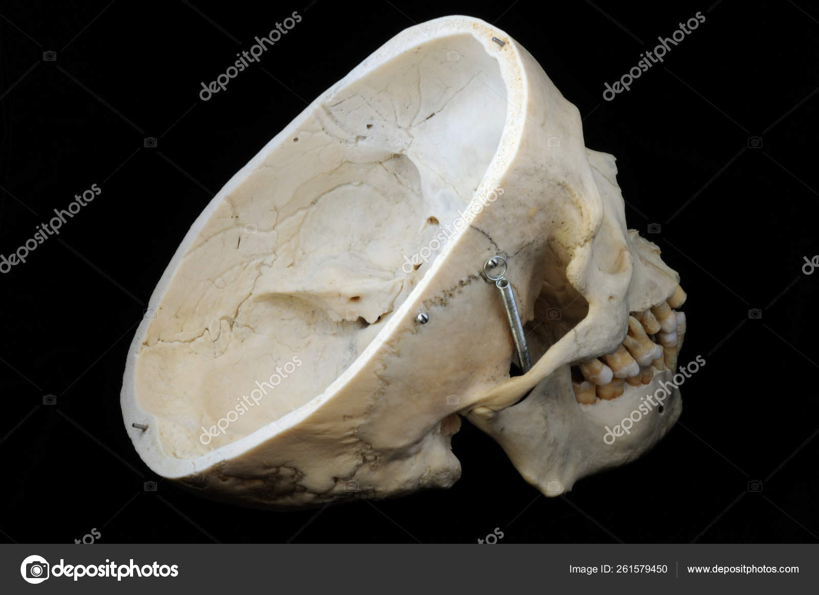 Real Human Skull Cap Cut Away Show Interior Brain Case