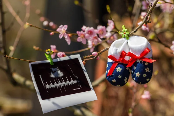 Baby Pantoffels Echografie Afbeelding Opknoping Een Tak Van Bloeiende Boom — Stockfoto