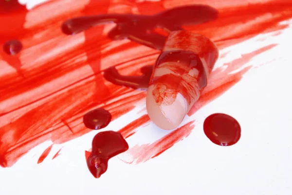 Closeup Persons Severed Thumb Pool Blood — Stock Photo, Image