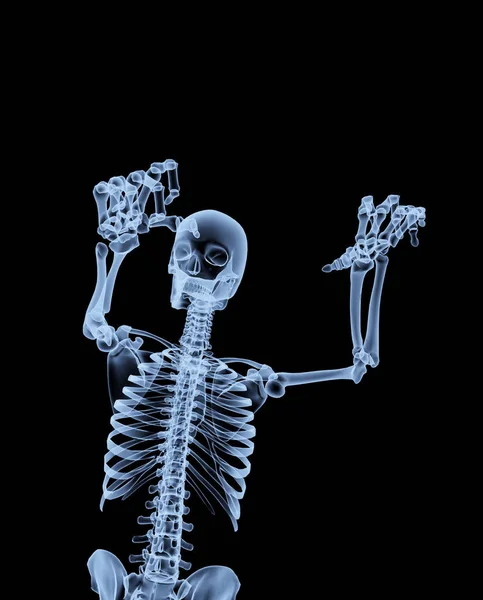 An x ray of a human skeleton in a pose.