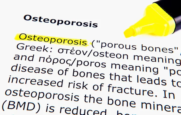 Osteoporose Texto Medicina Saúde — Fotografia de Stock