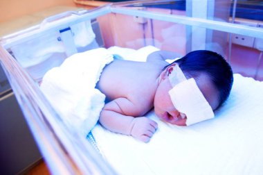 Newborn baby with jaundice under ultraviolet light in the incubator. clipart
