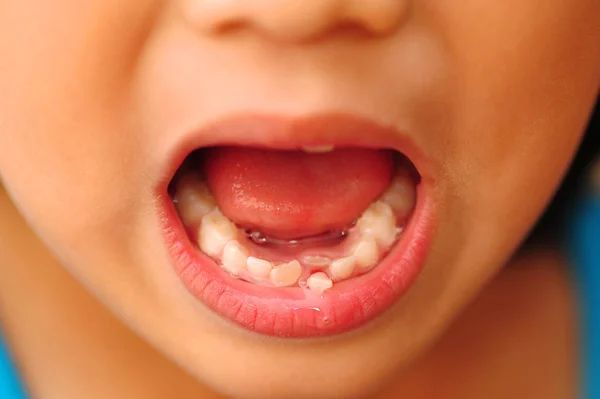 Крупним Планом Знімок Дитячого Вільного Зуба — стокове фото